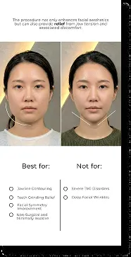 BodyFactory Masseter Email: #2