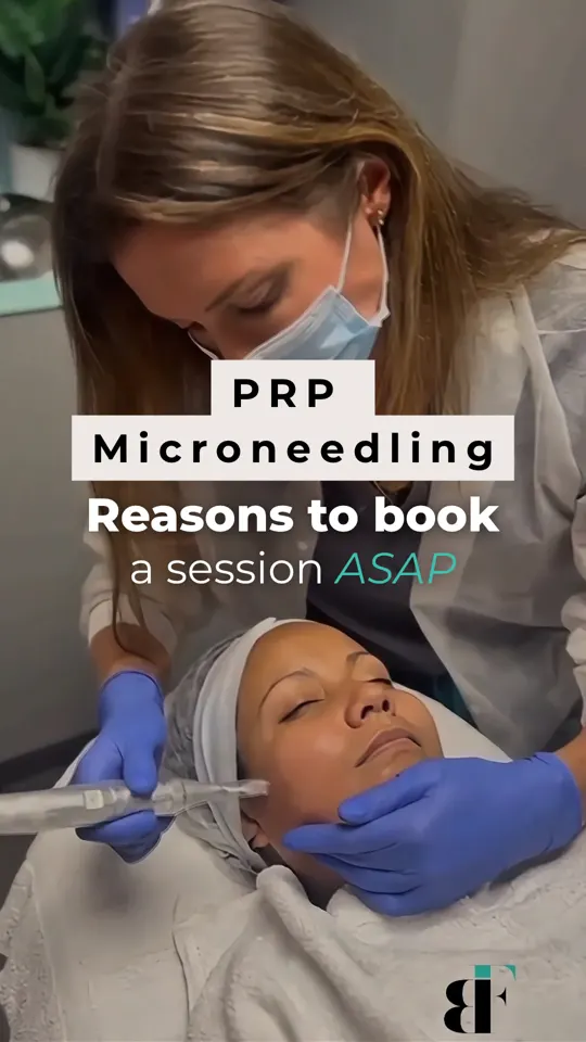 BodyFactory Microneedling Ad: PRP, Reasons to Book, Cover Image