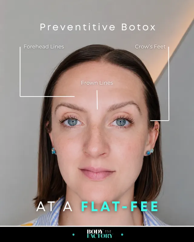BodyFactory Botox Ad: Campaign 3:4, #7