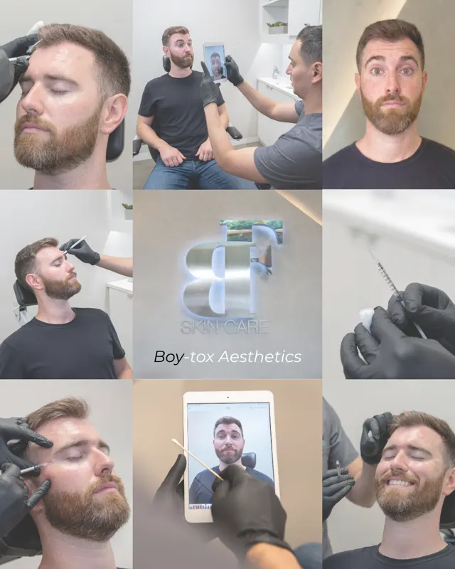 BodyFactory Botox Social Post: Boy Tox, #2