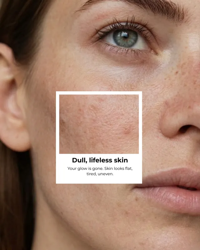 BodyFactory Brand Social Post: Skin Types Carousel, Slide 2