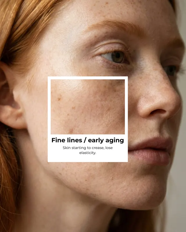 BodyFactory Brand Social Post: Skin Types Carousel, Slide 10