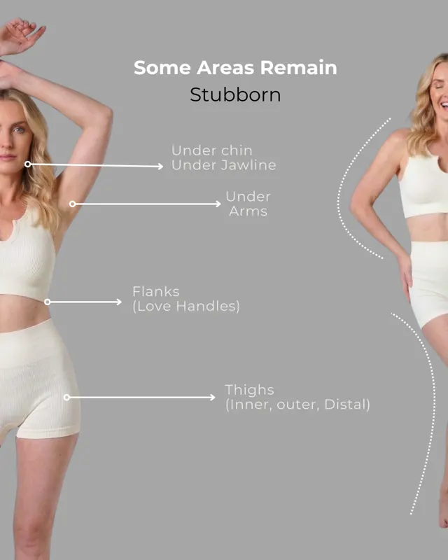 BodyFactory CoolSculpting Social Post: GLP1Weight Loss, Panel, #2