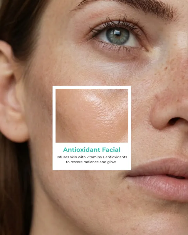 BodyFactory HydraFacial Social Post: 5 Signs Carousel, Slide 3