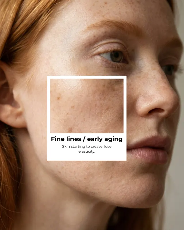 BodyFactory HydraFacial Social Post: 5 Signs Carousel, Slide 10