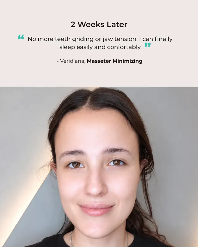 BodyFactory Masseter Social Post: Jawline Treatment, #3