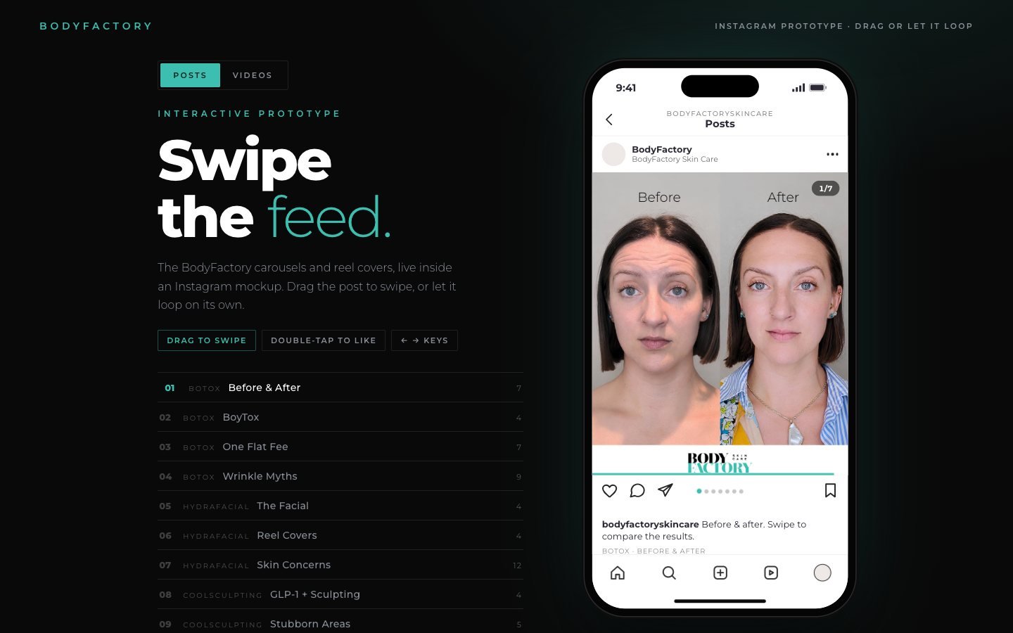 BodyFactory Instagram prototype: a phone mockup showing a Botox before-and-after carousel next to the list of post series