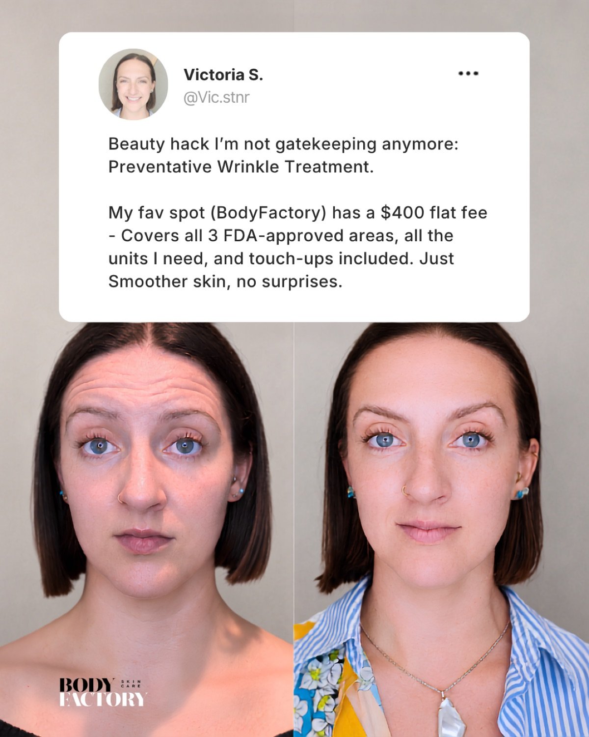 Meta Ads Collection — 1