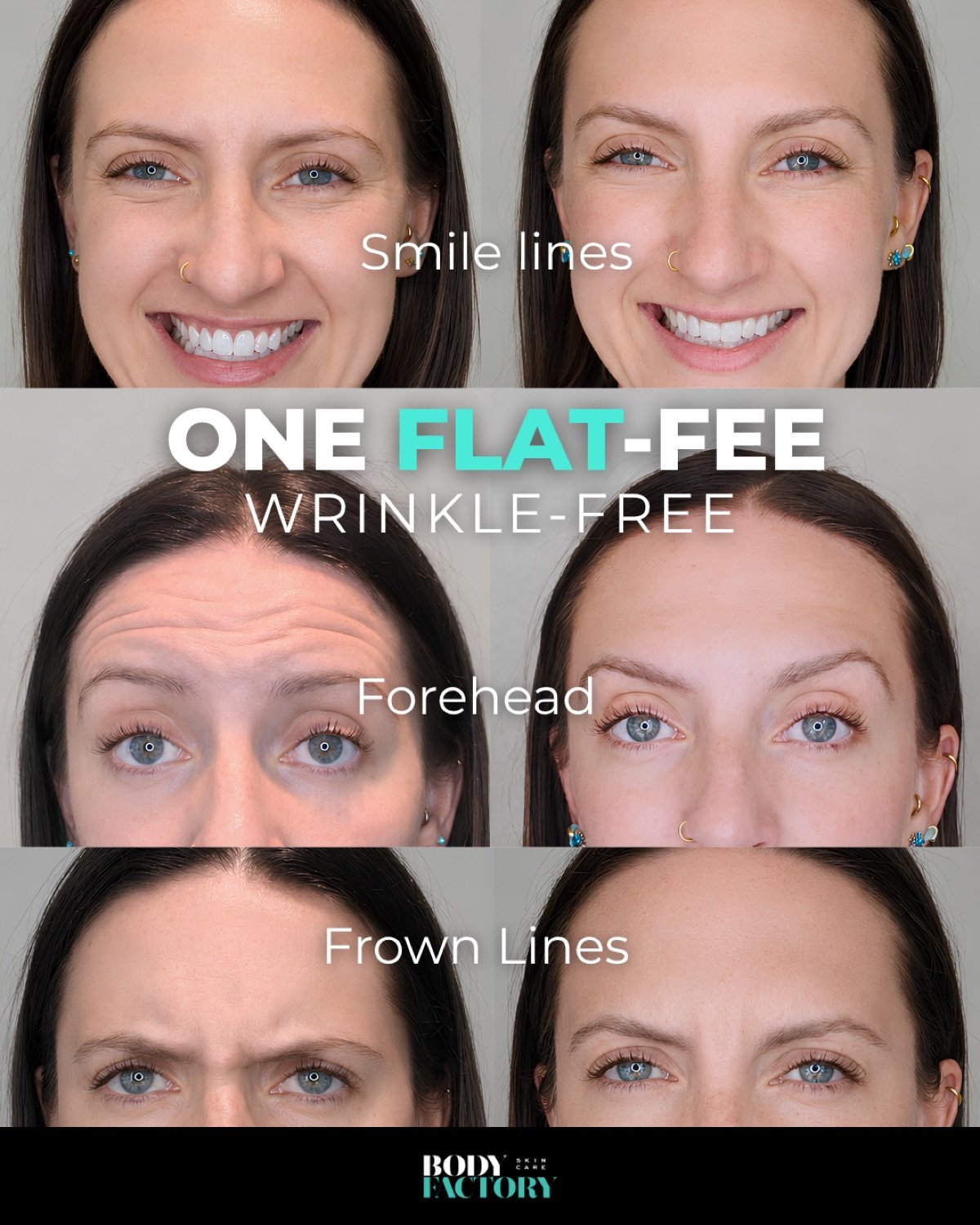 Meta Ads Collection — 5
