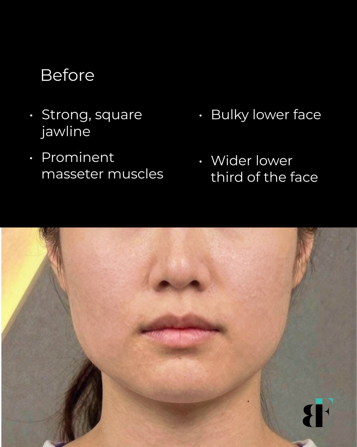BodyFactory Instagram — Instagram Post - 40